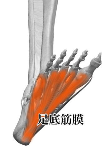 足の痛みと踵骨棘
